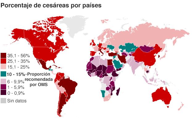 Infografía Porcentaje de cesáreas en países del mundo