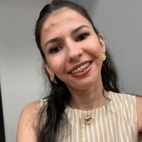 Vitória, Babá em Araras