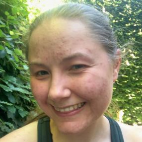 Emilie Louise Damgaard, Babysitter i Hillerød